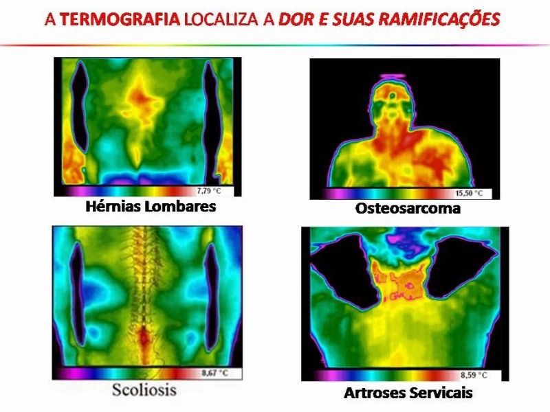 Procedimento